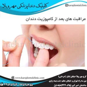 مراقبت-های-بعد-از-کامپوزیت-دندان