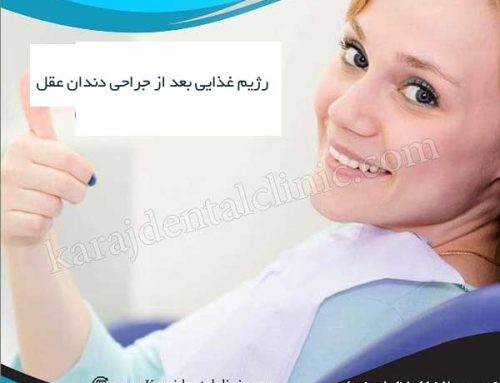 رژیم غذایی بعد از جراحی دندان عقل | تغذیه بعد از کشیدن دندان عقل