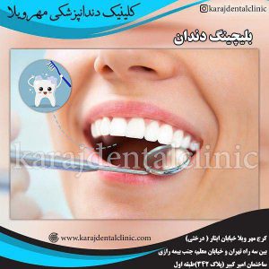 مراقبت های بعد از بلیچینگ دندان