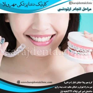 مراحل انجام ارتودنسی
