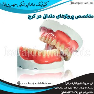 متخصص پروتزهای دندانی در کرج