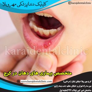 متخصص بیماری های دهان در کرج