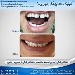 دندانپزشکی زیبایی و درمانی