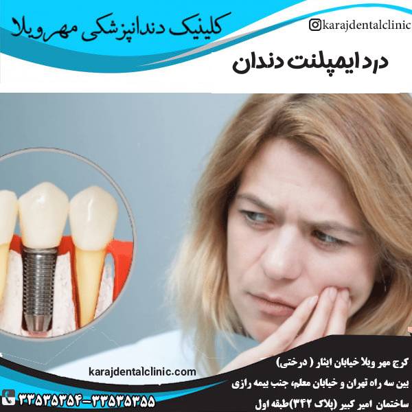 درد ایمپلنت دندان