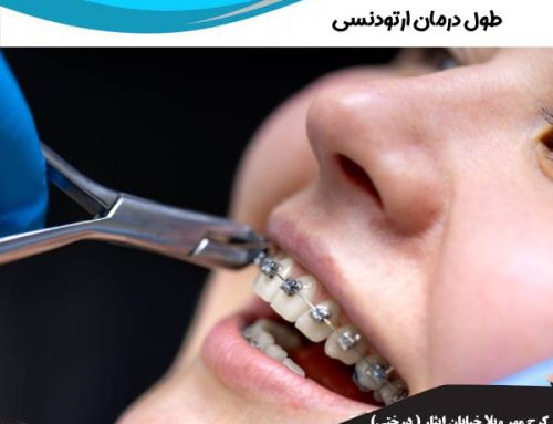 طول درمان ارتودنسی در کودکان و بزرگسالان | مدت درمان ارتودنسی
