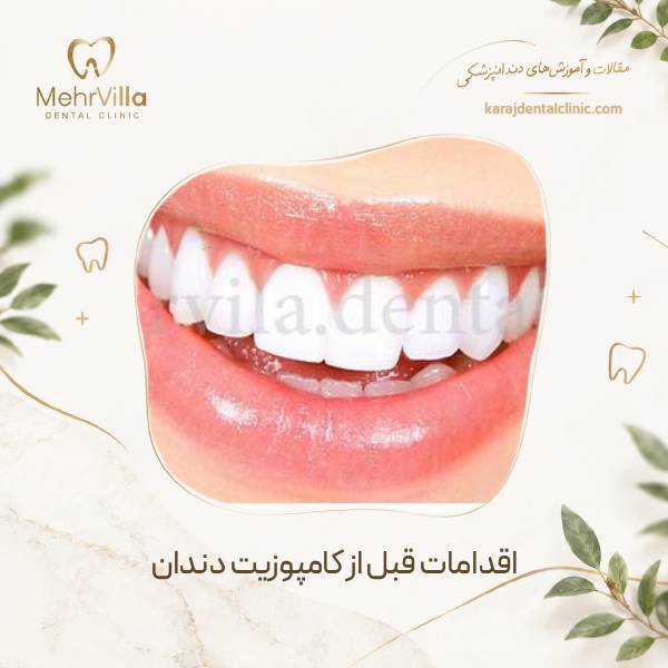 اقدامات قبل از کامپوزیت دندان