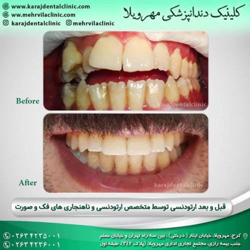 ارتودنسی دندان 10