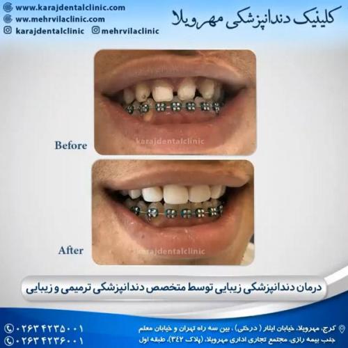 دندانپزشکی ترمیمی و زیبایی 1