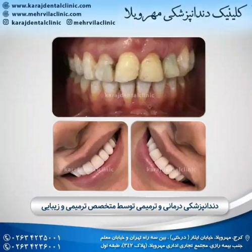 دندانپزشکی ترمیمی و زیبایی 10