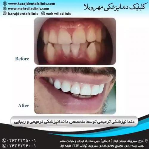 دندانپزشکی ترمیمی و زیبایی 15