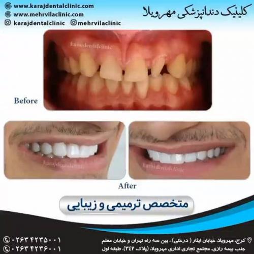 دندانپزشکی ترمیمی و زیبایی 21