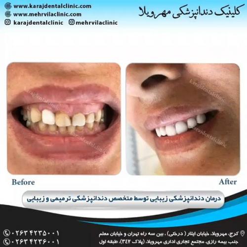 دندانپزشکی ترمیمی و زیبایی 7